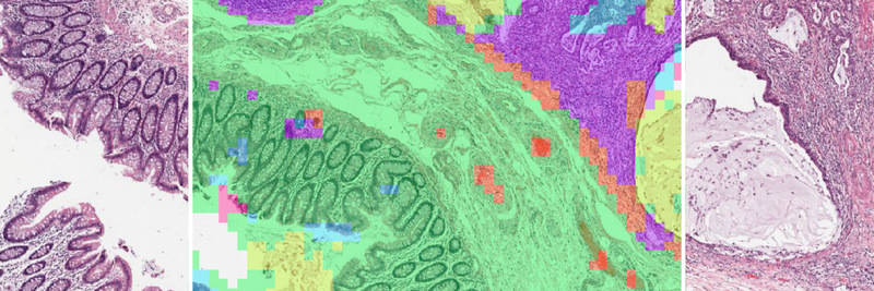 Advancing Diagnostics with AI and Digital Pathology
