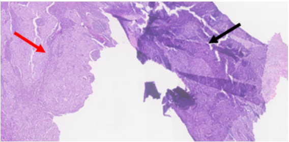 A close-up of a purple and white map AI-generated content may be
incorrect.