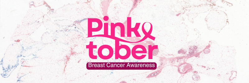PAICON’s AI Solution for Breast Cancer Diagnostics