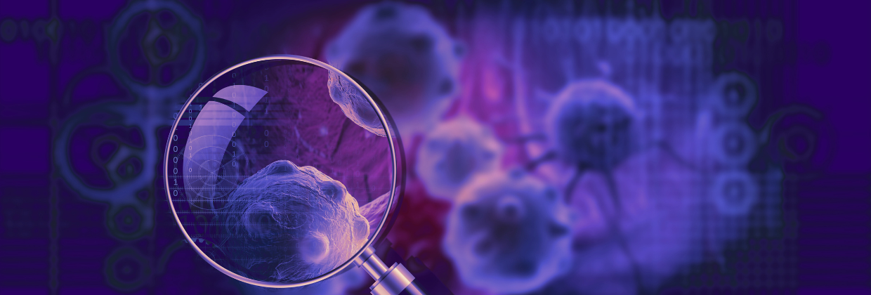 How AI and Big Data Are Changing Breast Cancer Treatment