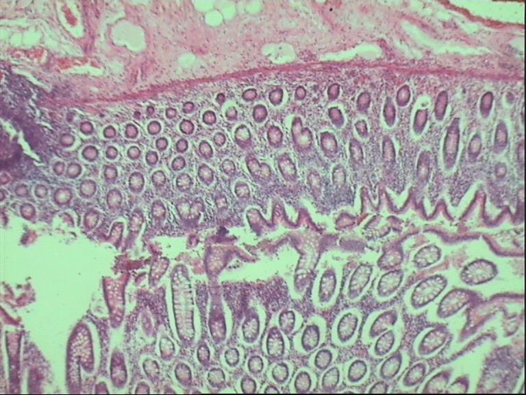 H&E Colon Slide
