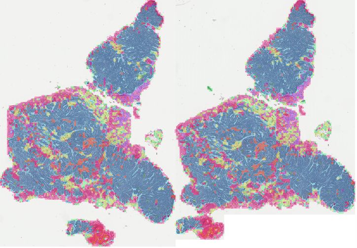 Tissue segmentation