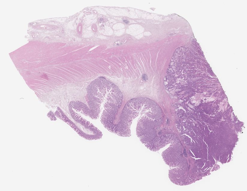 Sample C