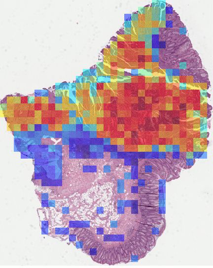 Attention heatmap