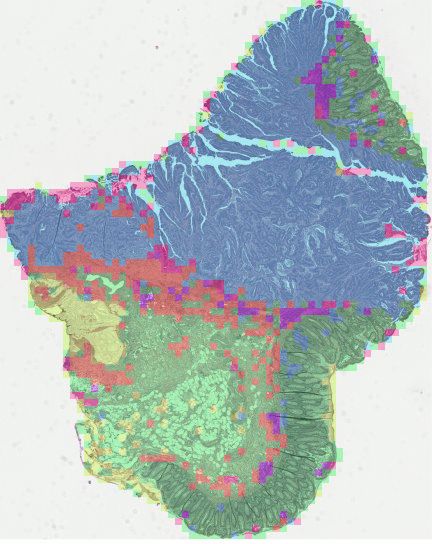 Tissue segmentation