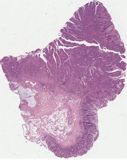 H&E pathology slide captured at the point of care
